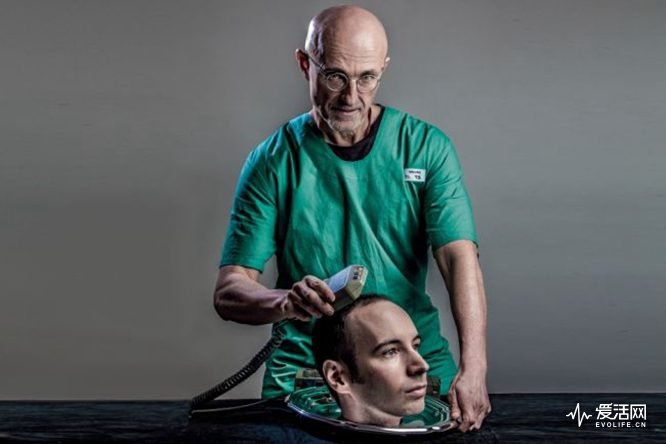 Sergio-Canavero-head-transplant-on-Valery-Spiridonov